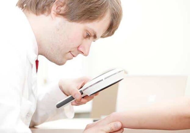 Dijagnoza psorijaze od strane dermatologa