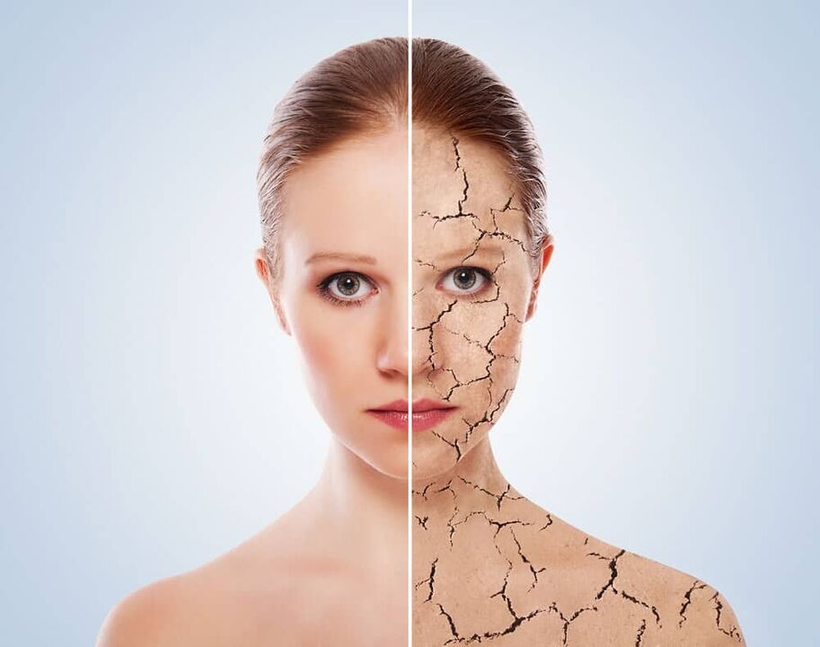 Zdrava koža i koža zahvaćena psorijazom